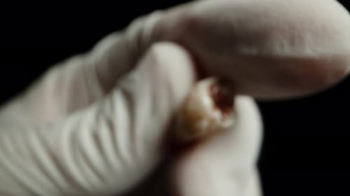 Hand in a White Medical Glove Examines a Bloodied Human Tooth, Close-up.