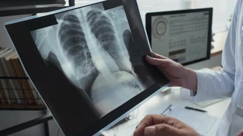 Hands of Two Doctors Pointing at Chest X-Ray and Discussing Diagnosis