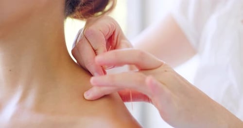 Acupuncteur caucasien traitant un patient métisse en clinique