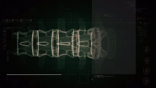 Biotech X-ray scan of lumbar spine