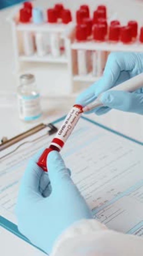 Medical Professional Analyzing COVID-19 Blood Sample