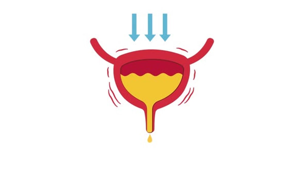 Animated Bladder Icon Showing Urinary Incontinence, Backgrounds Motion ...