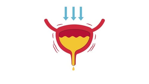 Animated Bladder Icon Showing Urinary Incontinence