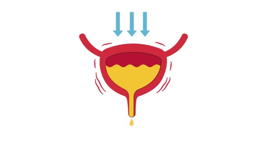 Animated Bladder Icon Showing Urinary Incontinence, Backgrounds Motion ...
