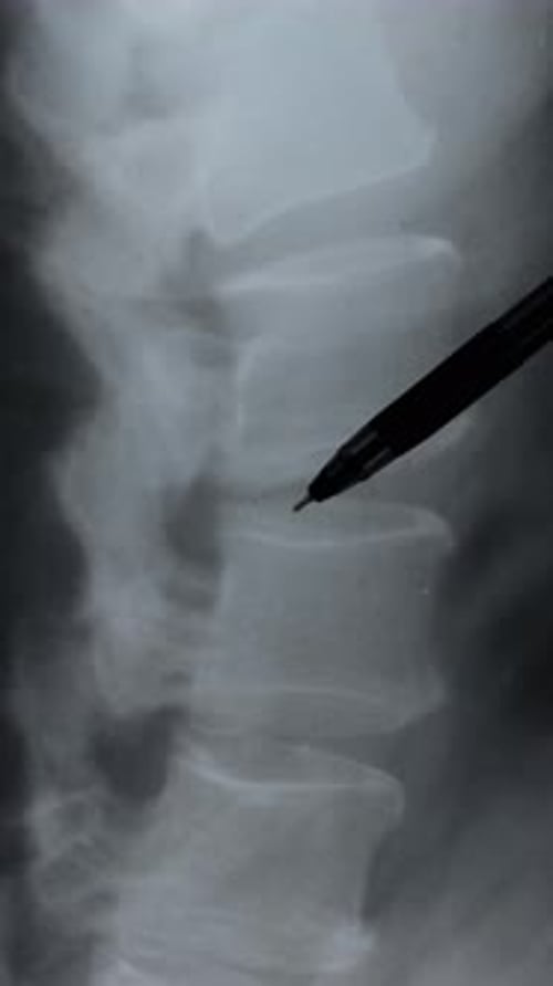 Close Up Vertical Footage x ray scan