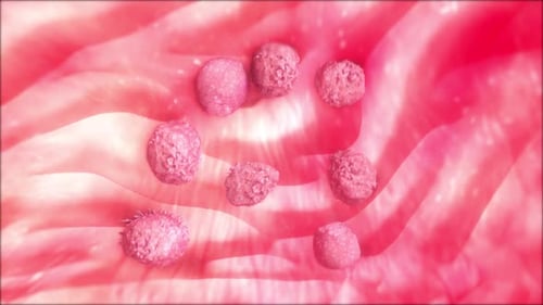 Microscopic View of Tumor Growth on Healthy Tissue in Pink Tones