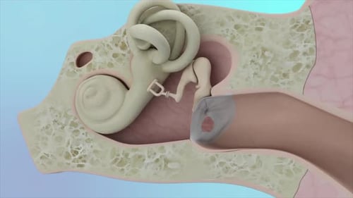 3D Animation of Inner Ear Anatomy and Sound Perception