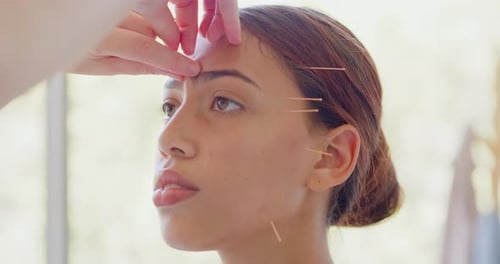 Gros plan d'une acupunctrice soignant une patiente métisse à la clinique