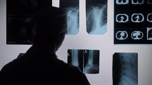 Radiologist Examining X Ray Images on Lightbox in Medical Facility