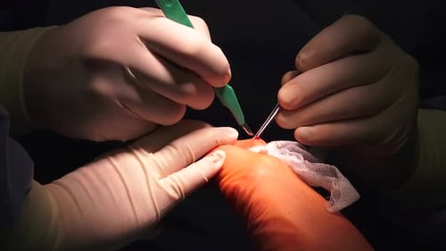 Surgeons Perform Wrist Surgery in Hospital Setting