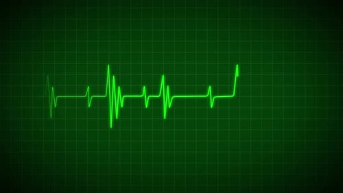 Digital Heartbeat EKG Line on Medical Monitor Screen