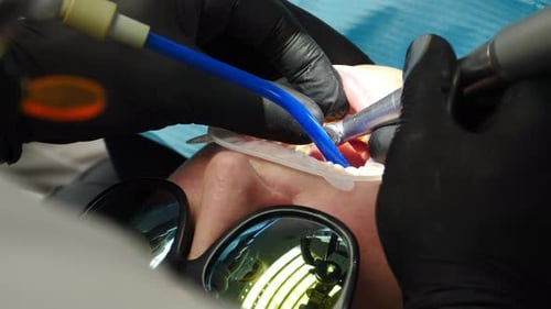 Dental procedure with suction and drill, close-up view