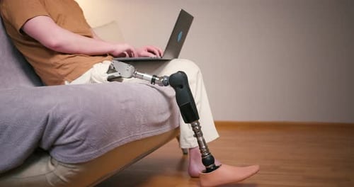 Adult With Prosthetic Leg Using Laptop Indoors