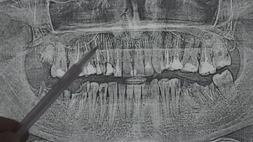 Dental X-Ray Examination with Pointer in Black and White