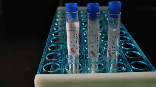 COVID-19 Positive Test Vials in a Rack
