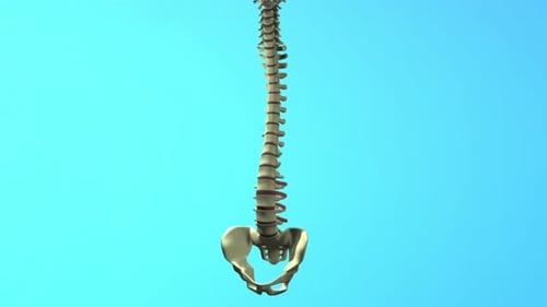 Illustrating vertebral body replacement surgery on human spine