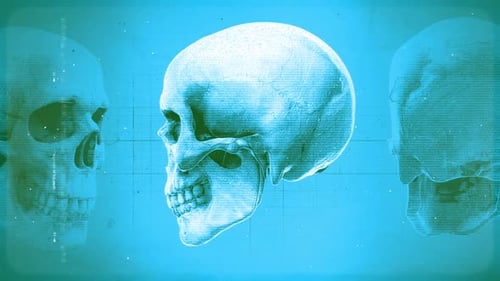 Medical Chart Skull 06