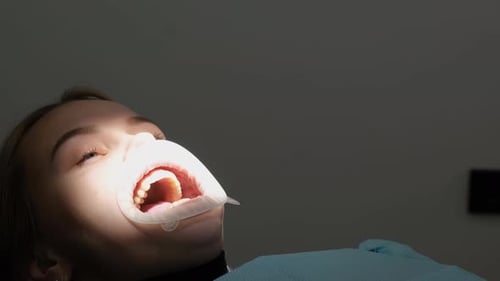 Paciente femenina con la boca abierta durante el tratamiento dental Capa durante el tratamiento