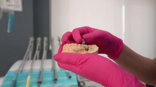 Dental mold with implant component being adjusted
