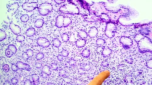 Hand Points to Purple Cells under Microscope