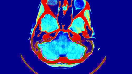 Advanced Brain Scan Animation in Heatmap Style