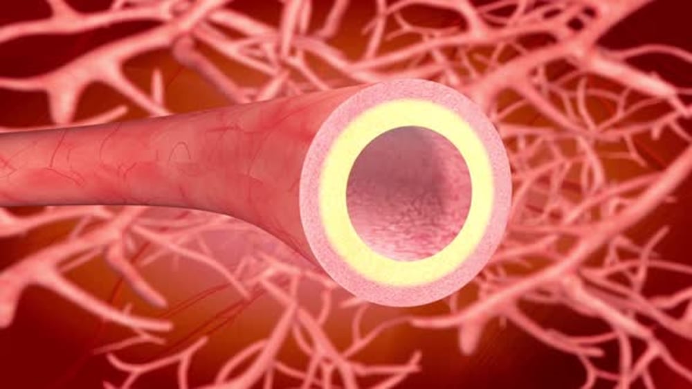 Artery Plaque Clearing in Blood Vessel Medical Animation, Backgrounds ...