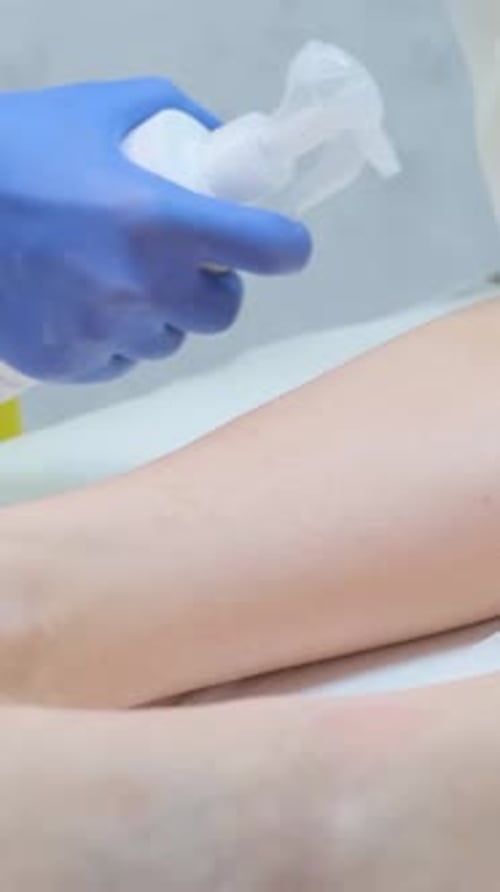 Gloved Hand Sprays Liquid on Leg in Clinic
