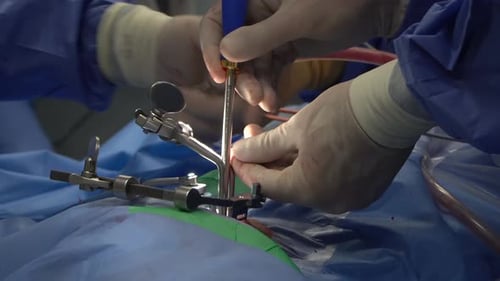 Medical Professionals Perform Surgical Procedure in Hospital
