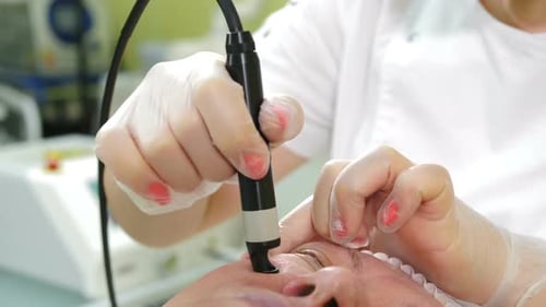 Beautician Curing Rosacea and Coagulating Capillary By Laser Apparatus in Modern Beauty Clinic
