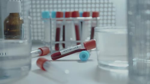 Blood Samples in Laboratory Test Tubes