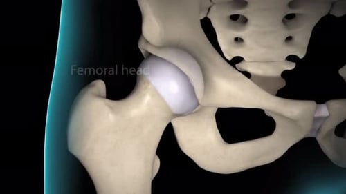 3D Human Hip Joint Anatomy and Degenerative Disease Animation