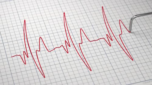 Heart Rhythm Chart and Cardiac Examination Paper Electrocardiogram Close Up Animation