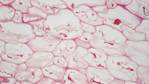 Polliondium de Funaria en coupe longitudinale au microscope 400x contre fond clair