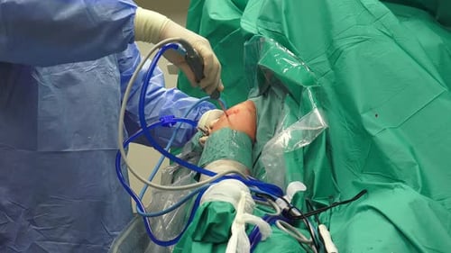 Surgeons Performing Knee Surgery