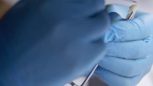 Close Up Dentist Working on Tooth with Precision