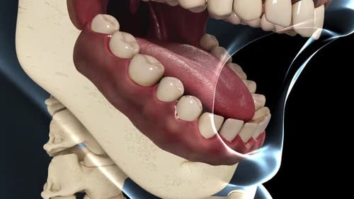Detailed 3D Animation of Dental Implant in Jawbone Anatomy