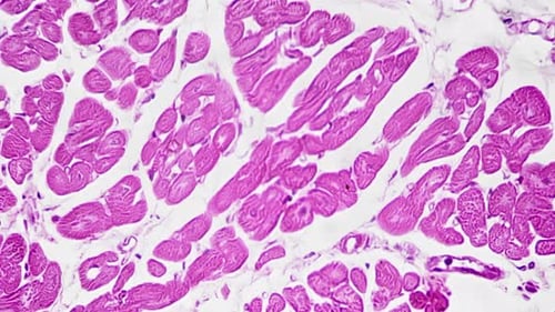 Sample of Large Vein in Section Magnified Under Microscope in 200 Times on White Background