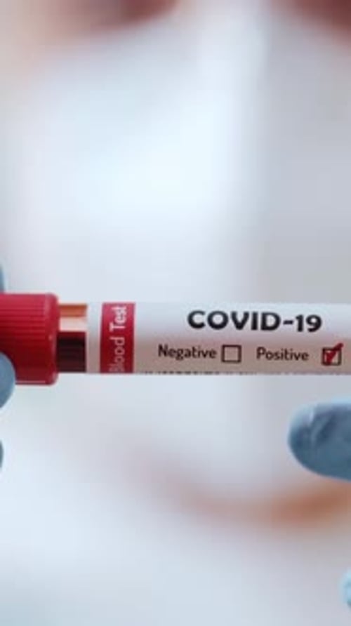Positive COVID-19 Blood Test Held by Medical Professional