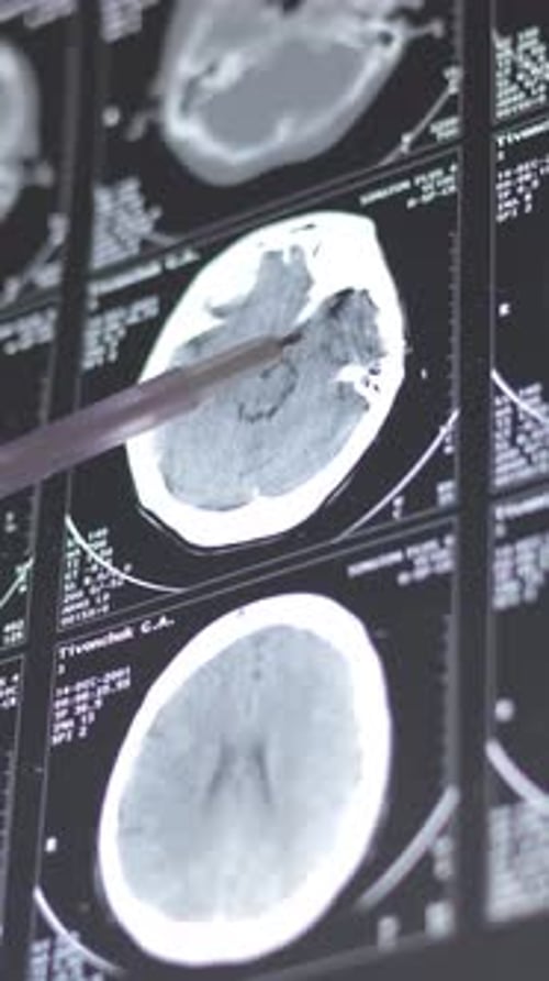Doctor learning Brain computed tomography