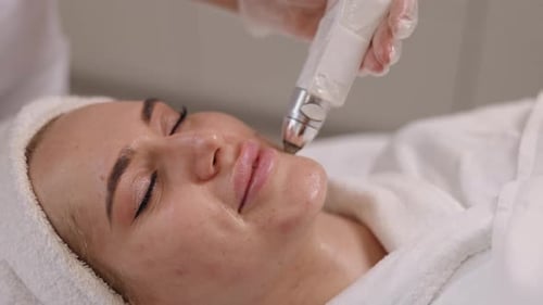 Beauty Salon Remove Facial Redness RF Face Lifting