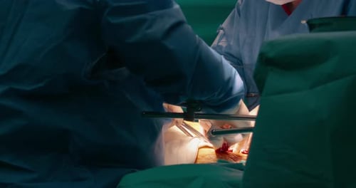 Cancer Surgery in Clinic