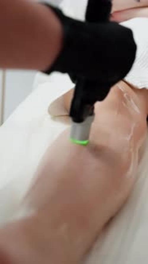 Laser Hair Removal Treatment on Leg in Clinic