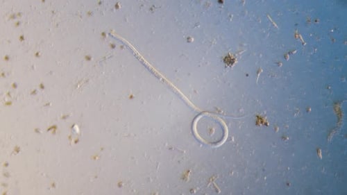 Nematode parasitic worm in microscope bright field