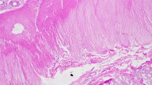 Pyloric Region in Section Magnified with Laboratory Microscope 100x Against Bright Field Background