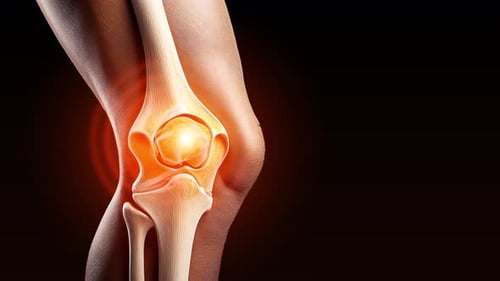 The Leg knee joint Pain is highlighted animation