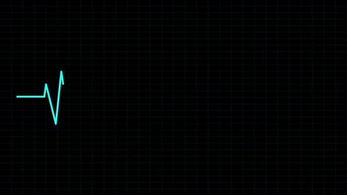 Heartbeat Monitor Interface