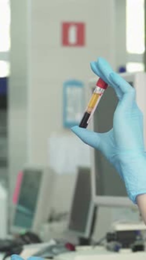 Close Up Blood Test in Medical Clinic Setting