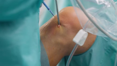 Surgeon Performing Arthroscopic Knee Surgery - close-up. Doctor Makes a Cut With Scalpel