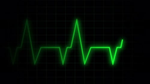 Medizinisches EKG-Herzfrequenzmesser-Display