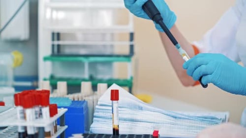 Medical nurse in blue protective gloves uses laboratory equipment in clinic.